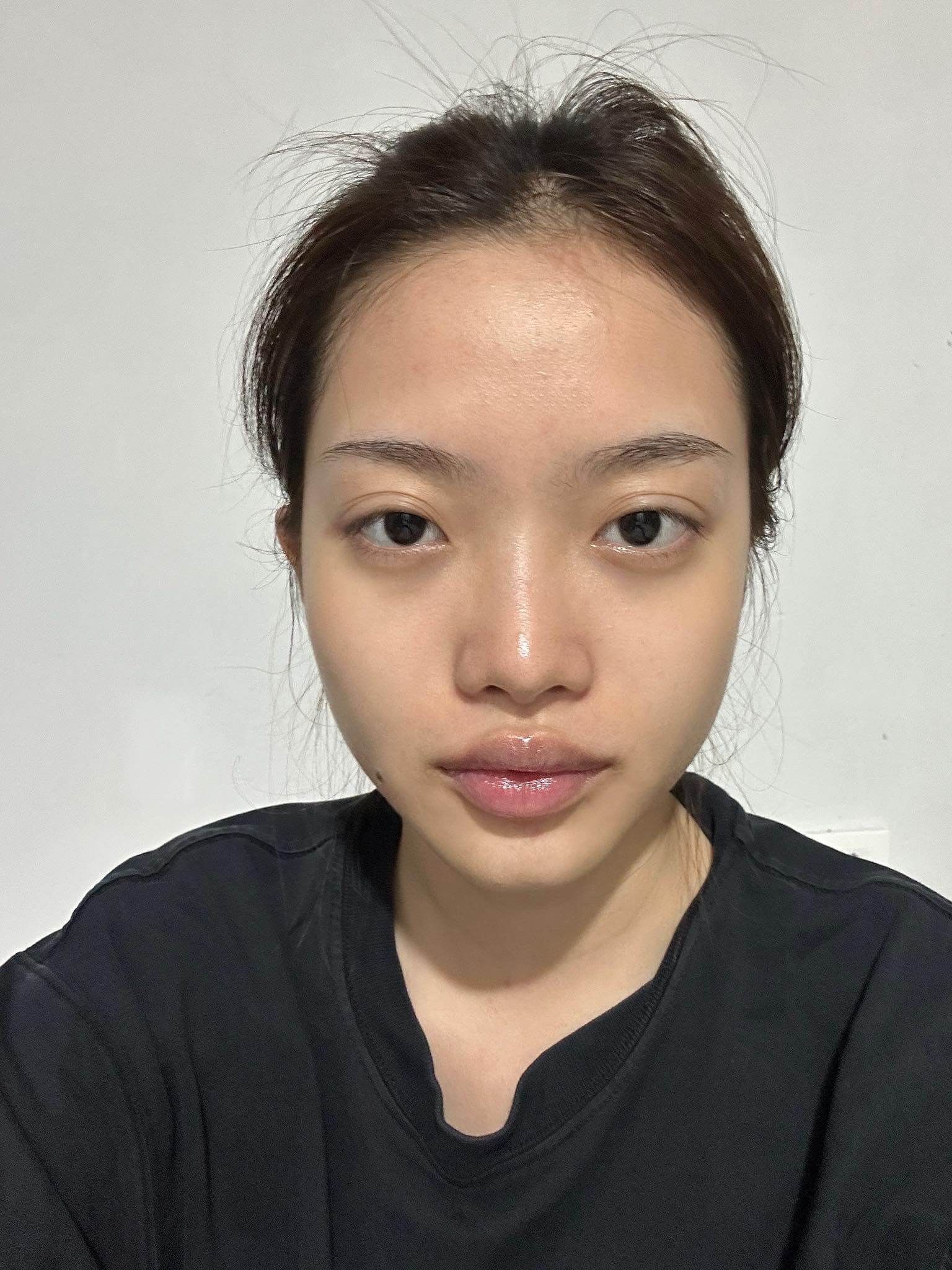 Mặt mộc trước khi trang điểm — Da khô và quầng mắt